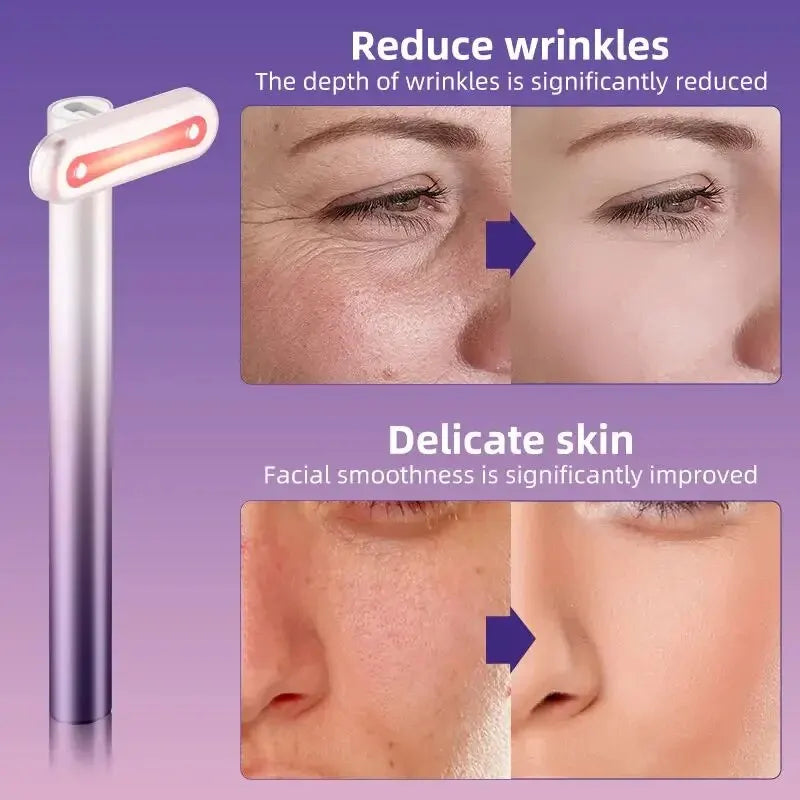 Microcurrent 4 in 1 Electric EYE Dark Circles Fairy Stick EMS Face Neck Skin Care Massage Stick Facial Massager Wand
